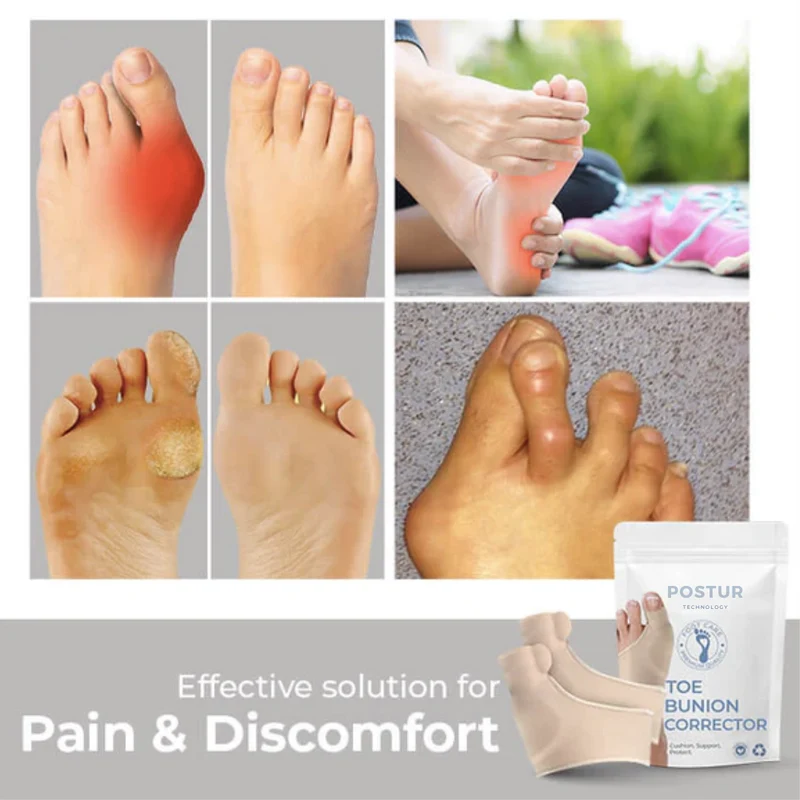 Skanto | Hallux Valgus Korrektor 2.0 – Korrigierende Unterstützung – Schmerzlinderung – Komfortabel – Wanduhr