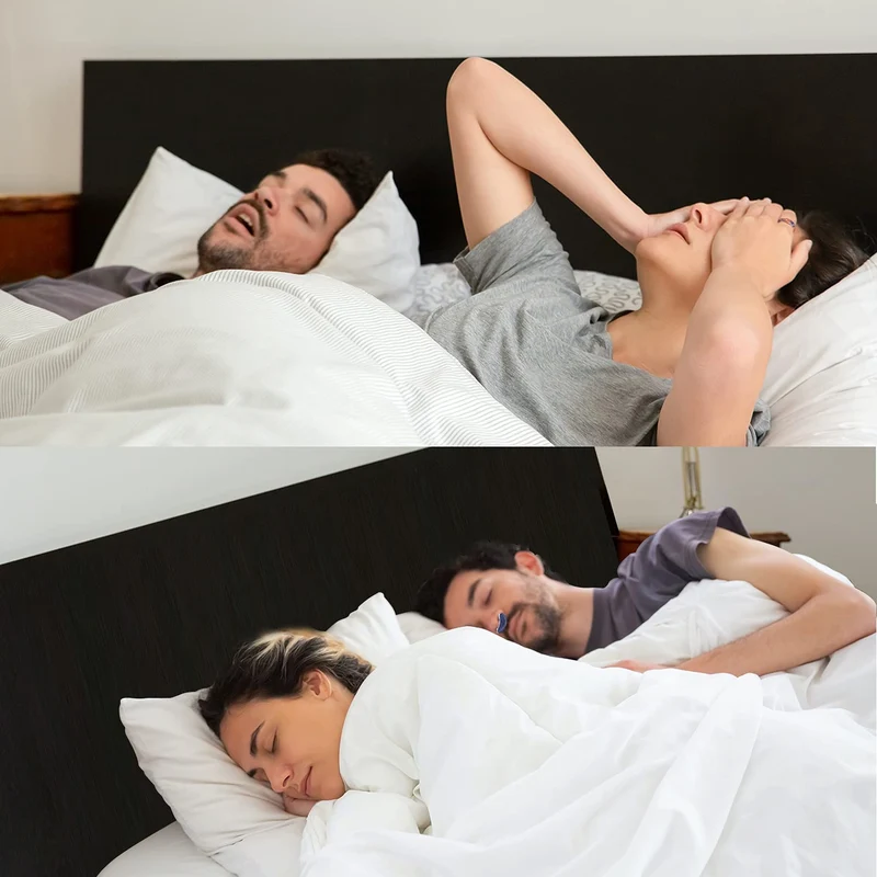 Skanto | Anti-Schnarch-Gerät | Schlauchloses, maskenfreies Micro-CPAP
