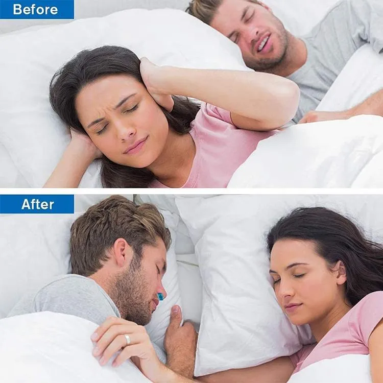 Skanto | Micro-CPAP Anti-Schnarch-Gerät